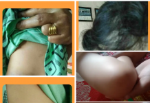 Viral.!! Beredar Unggahan Facebook Foto Balita Luka Lebam Diduga Jadi Korban Penganiayaan Orang Dekatnya